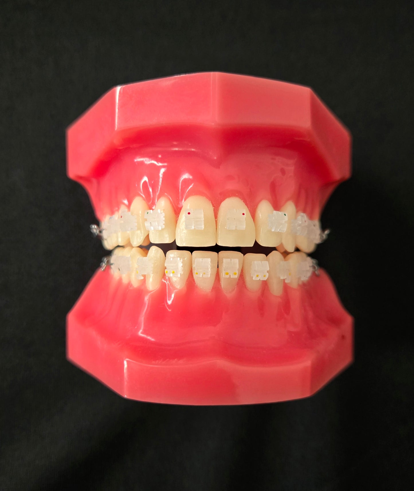CX Ceramic .022 MBT Brackets Hooks 3,4,5's
